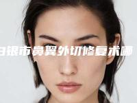 白银市鼻翼外切修复术哪些医院好(白眼星灿医疗美容诊所等领衔三甲)