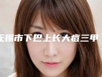 无锡市下巴上长大痘三甲医院-无锡市下巴上长大痘医院上榜名单前十佳名单新版发布